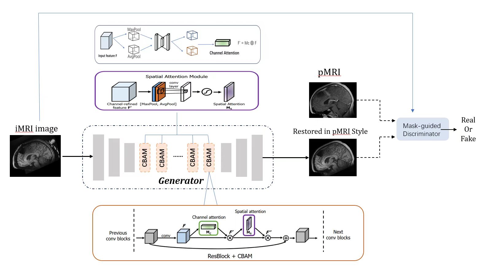 Attention-guided MRI restoration model architecture
